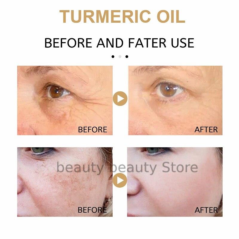 Turmeric Dark Spot Corrector Serum